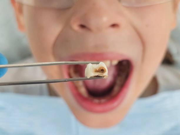 Best Weekend Emergency Dentist in North Prairie, WI